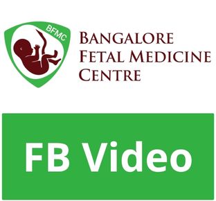 FB Video